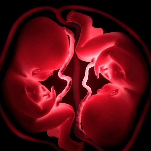 Twins pregnancy