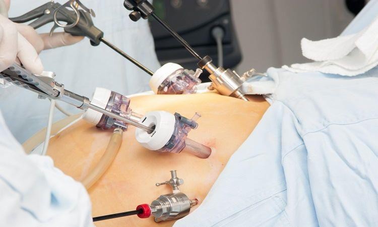 laparoscopic gynecology surgery in Sion