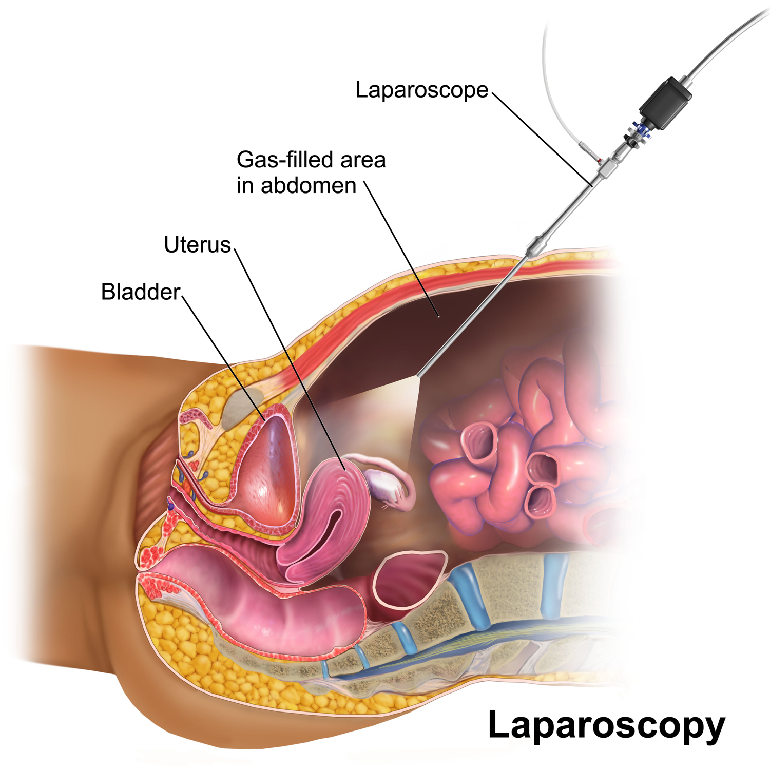 Laparoscopic Gynecologist in Sion