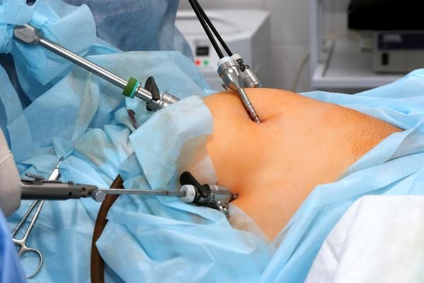 Laparoscopic gynecologist in Sion - Mumbai