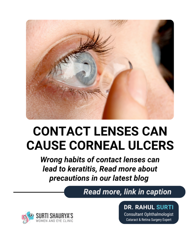 Corneal Ulcer Treatment Mumbai - Keratitis Specialist - Dr Rahul Surti