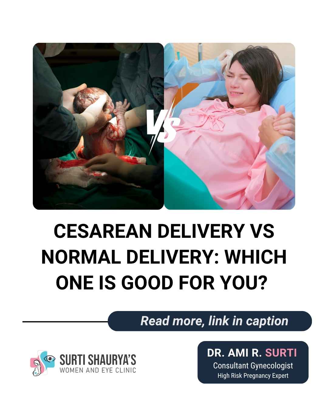 Cesarean Delivery in Mumbai C-Section vs Normal Delivery